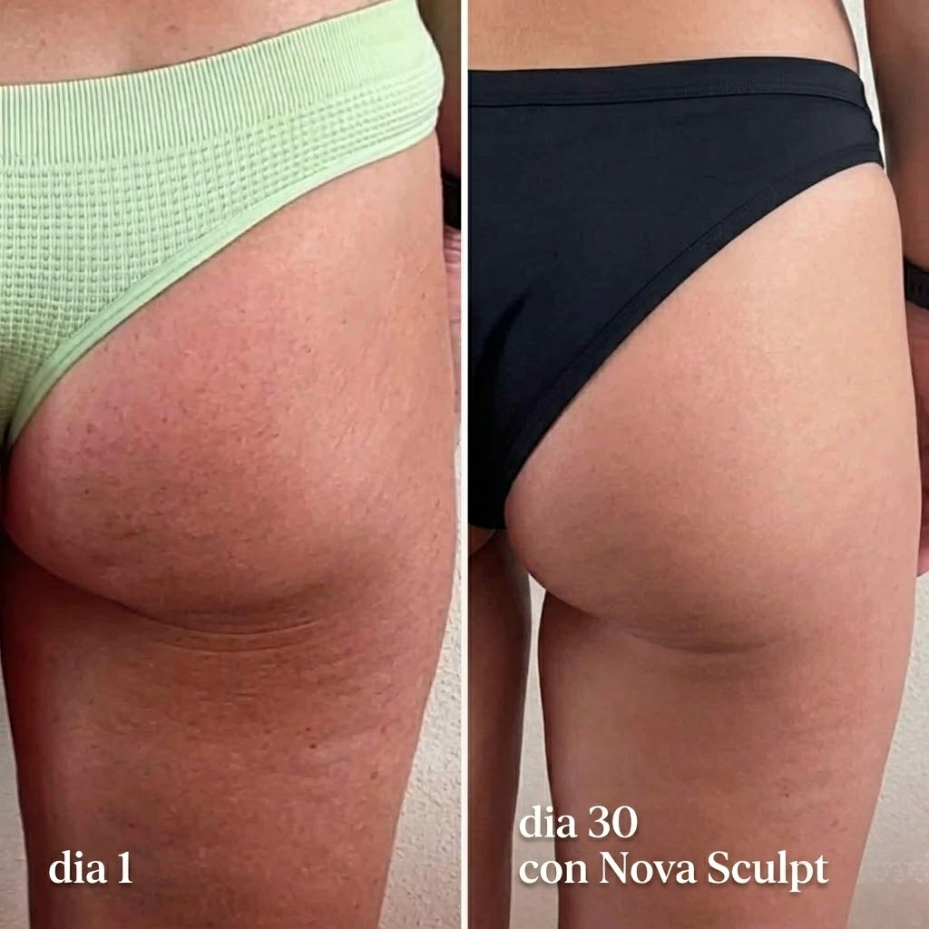 Dispositivo de Moldeo Corporal Nova Sculpt