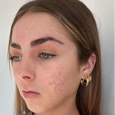 Después