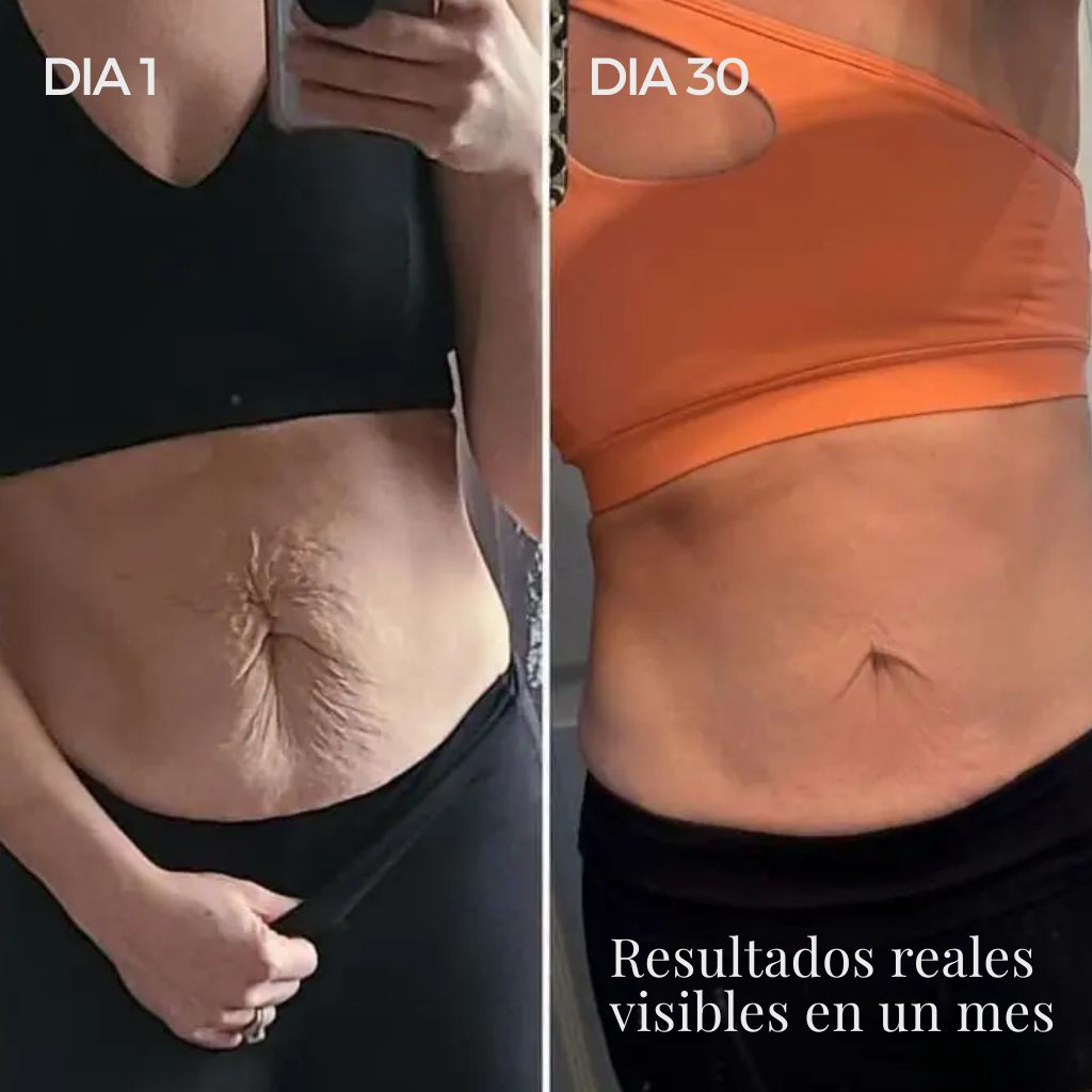 Dispositivo de Moldeo Corporal Nova Sculpt